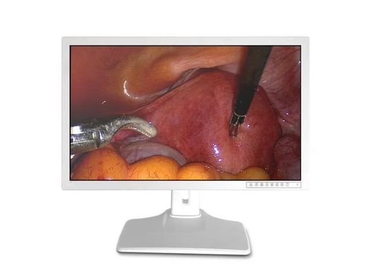Het medische Scherm 32inch 3840 X 2160 van de Endoscoopmonitor