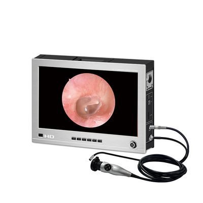 Medisch Draagbaar Systeem 15 van de Endoscoopcamera“ HDMI-SYNCHRONISATIE