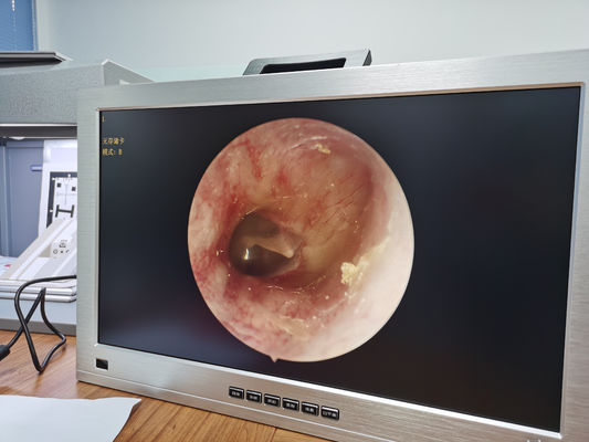 22 de duimmonitor integreerde ENT Volledige HD-het Systeem Vastgestelde Draagbaar van de Endoscoopcamera