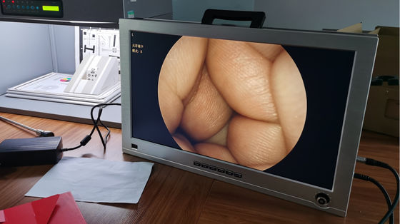 22 de duimmonitor integreerde ENT Volledige HD-het Systeem Vastgestelde Draagbaar van de Endoscoopcamera