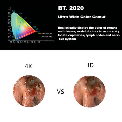 Systeem van de de Endoscoopcamera van Dec 3840A het Nieuwe 4K Ultrahd Medische voor Laparoscopie